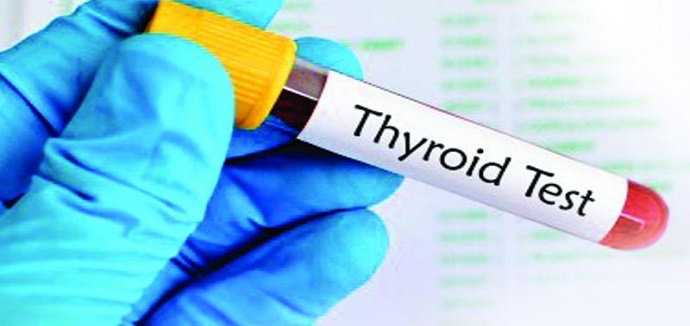 थायराइड के प्रकार(types of thyroid)